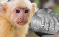 Estados Unidos advierte sobre un rebrote de la Viruela del Mono